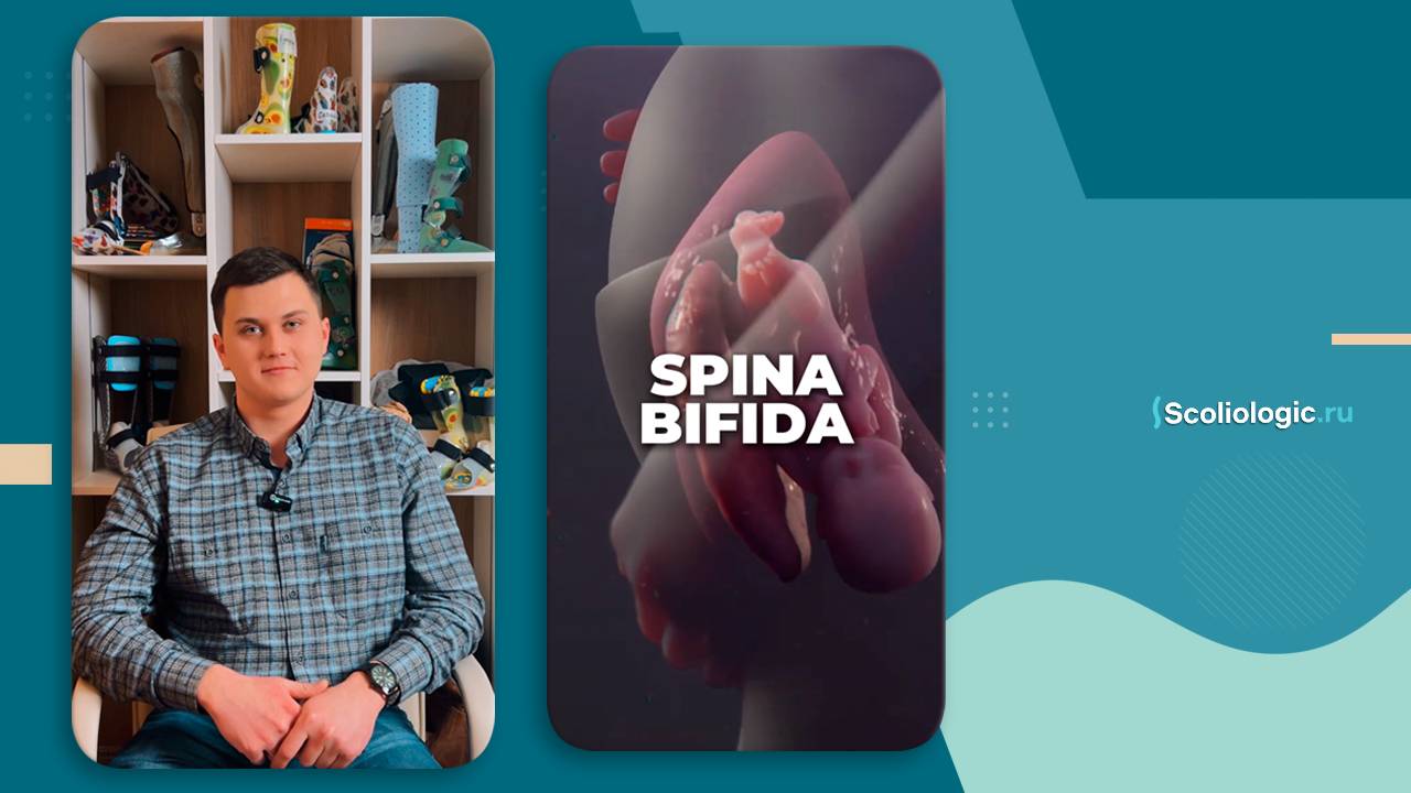 Помочь ребенку с Spina Bifida ходить – это возможно!