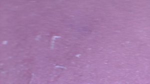 Стирательная резинка (ластик) под микроскопом