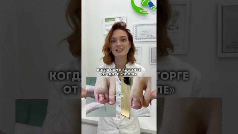 Чудес не бывает…Ваши ножки в надежных руках #подолог #подологмосква