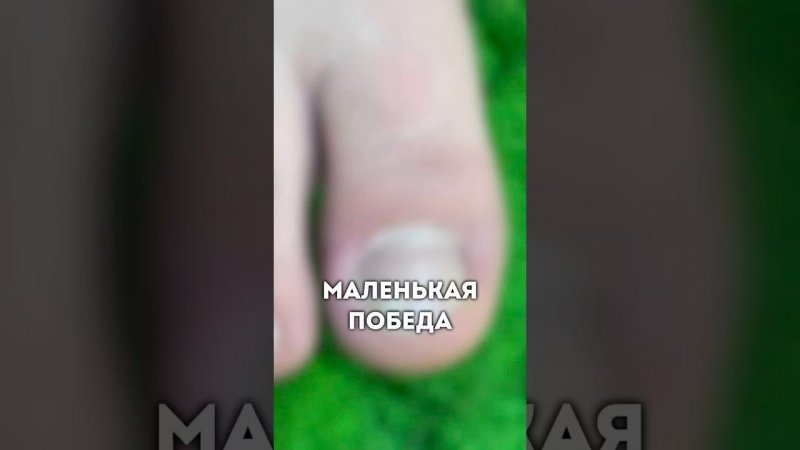 Как считаете, достойно? #подолог #подологмосква