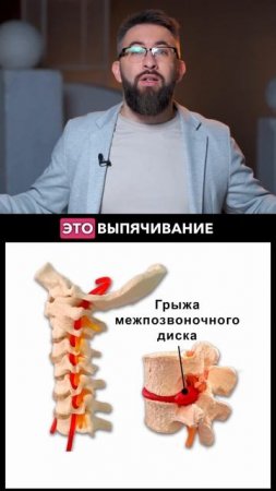 Почему боль в пояснице отдает в ногу?