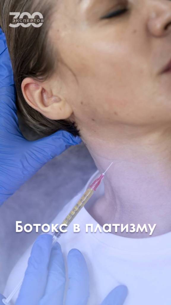 Ботокс в платизму против морщин на шее!
