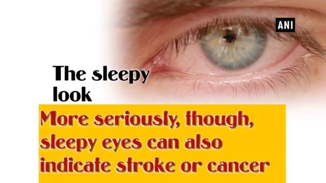 What your eyes say about your health смотреть онлайн