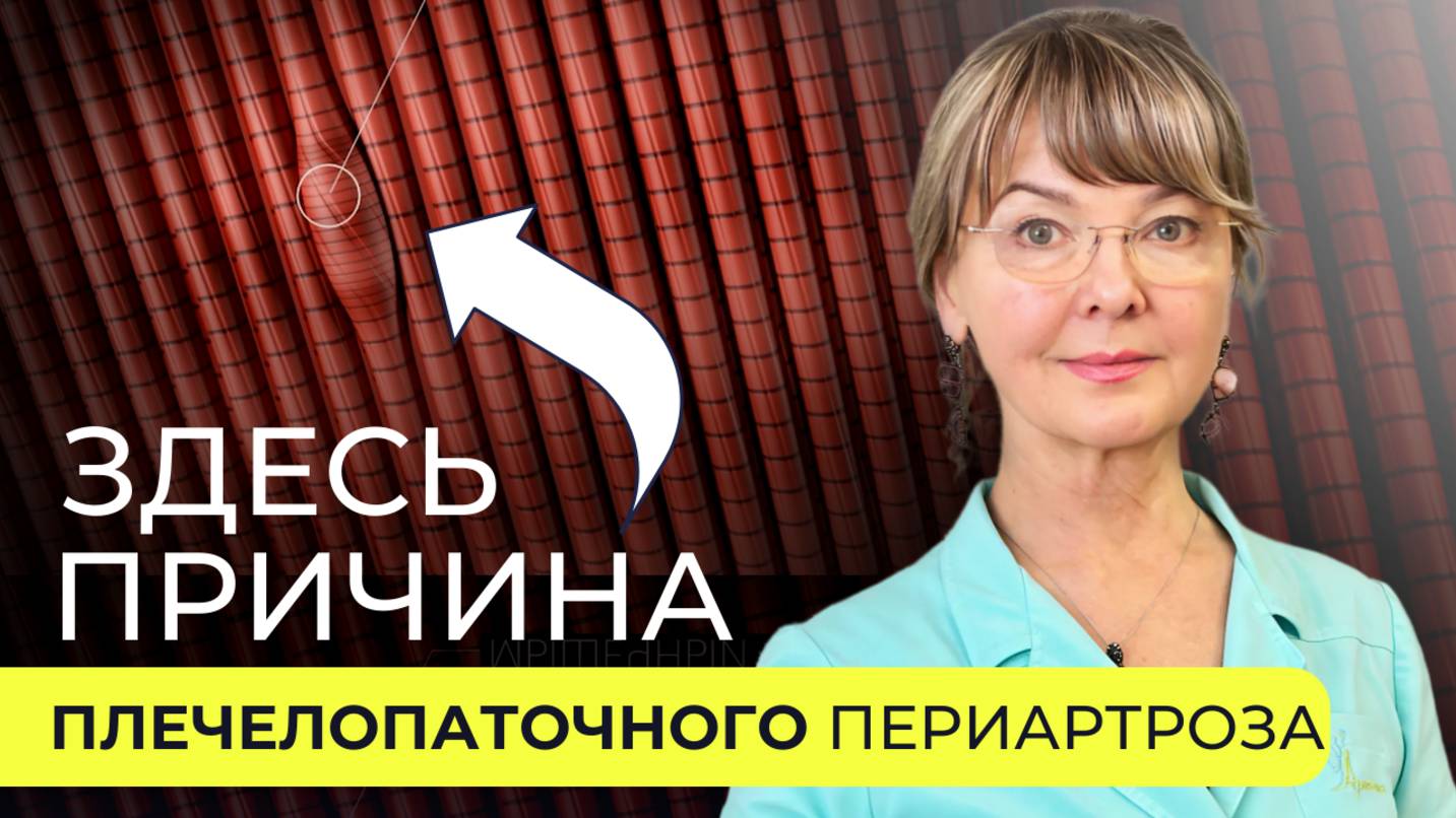 Когда болит плечо: подробный ответ на вопрос о плечелопаточном периартрозе