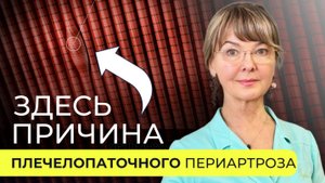 Когда болит плечо: подробный ответ на вопрос о плечелопаточном периартрозе