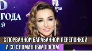 Анфиса Чехова Пожаловалась на Побои от Любовника