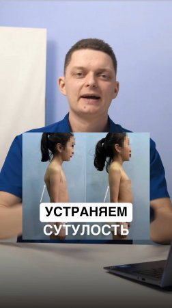 Как устранить сутулость за 1 курс занятий?