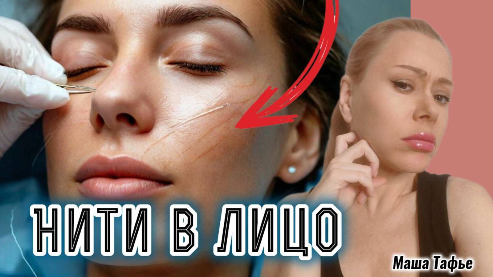 Яблочки на щеки: ставлю нити в лицо. Зима с Машей ❄️ Видео №74