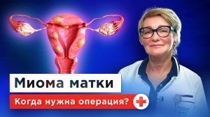 Всегда ли нужна операция при миоме матки? Гинеколог о причинах, симптомах и лечении