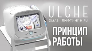 Принцип работы ULCHE: SMAS–лифтинга HIFU