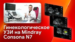 Стандартное гинекологическое исследование на Mindray Consona N7