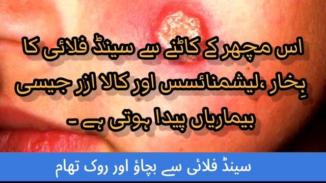 What is sandfly?causes, sign / symptom, awareness , precaution of sandfly. смотреть онлайн