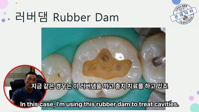 치과에 오면 고무풍선으로 입부터 틀어막는다고??? 러버댐의 중요성, The importance of the dental rubber dam to treat dental carie