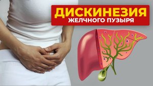 Дискинезия желчного пузыря. Как лечить? Причины и симптомы