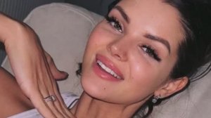 💕 Анна Самонина после ринопластики решила поставить виниры  | Новости Дом 2