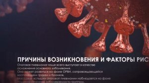 Очаговая пневмония стадии