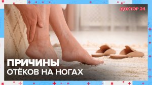 Из-за чего возникают ОТЁКИ? ТЕМЫ НЕДЕЛИ | Доктор 24