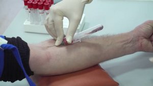 (13.02.2025) Участники СВО имеют право обслуживаться в поликлиниках вне очереди