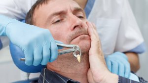 🦷 Сразу после удаления зуба: почему импланты так популярны