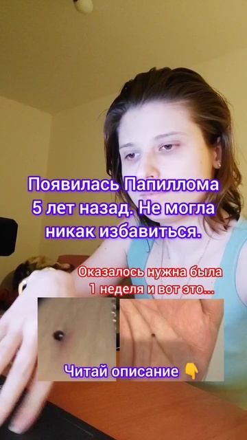 Папиллома