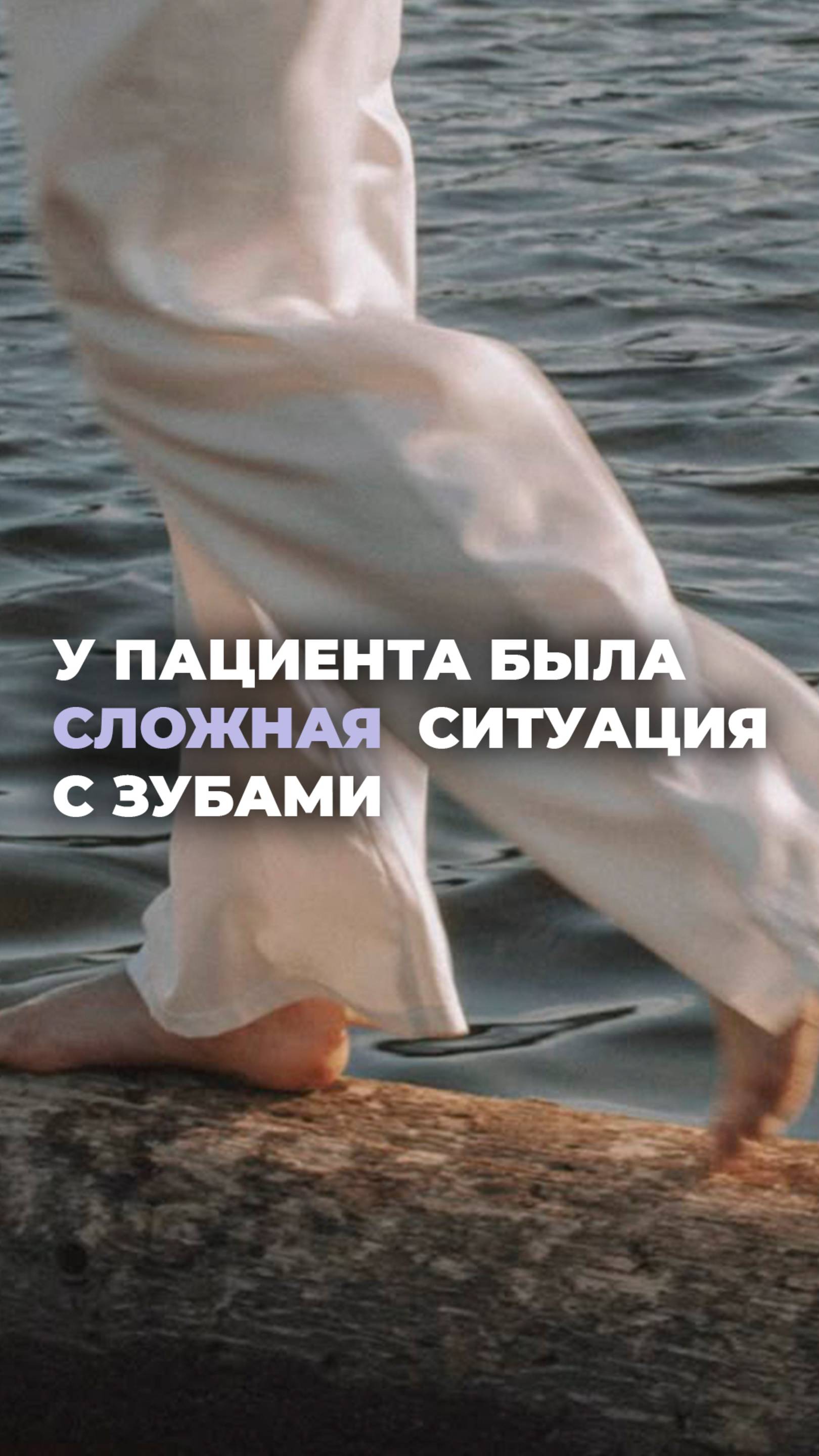 Когда у пациента была сложная ситуация с зубами, но ты не сдался и сделал ему идеальную улыбку!