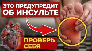 НЕ ПРОПУСТИ эти 4 ранних признака ИНСУЛЬТА! / Как сохранить сосуды здоровыми на ДОЛГИЕ годы?