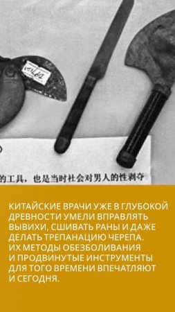 Краткий исторический очерк хирургии китайского народа