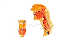Актуальные вопросы патологии лор органов профессор Никифорова Г.Н. Продукт: OLIOSEPTIL Sinus