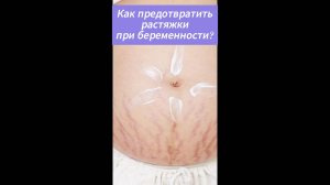 Как предотвратить появление растяжек при беременности?
