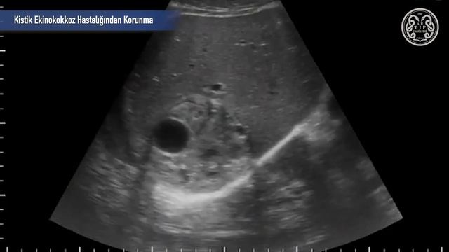 KURBAN BAYRAMI VE KİSTİK EKİNOKOKKOZ (KİST HİDATİK) HASTALIĞINDAN KORUNMA смотреть онлайн