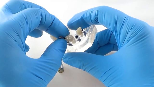 Neodent Open Tray Impression Coping Technique смотреть онлайн