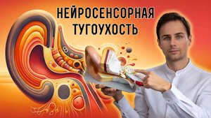 Самый частый тип снижения слуха _ Сенсоневральная тугоухость. Диагностика, профилактика, лечение.