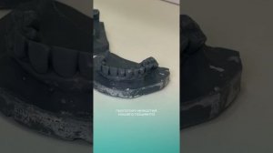 🦷 Хирургические шаблоны в стоматологии: Как они помогают при имплантации? 🔍