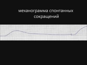 Гладкая мышца (эксперимент)
