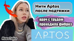 Нити Aptos после подтяжки: врач с трудом проходила фиброз. Зима с Машей ❄️ Видео №76