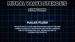 Mitral valve stenosis (Medical Condition)