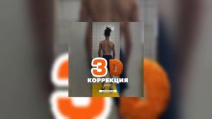 Трехмерная коррекция сколиоза