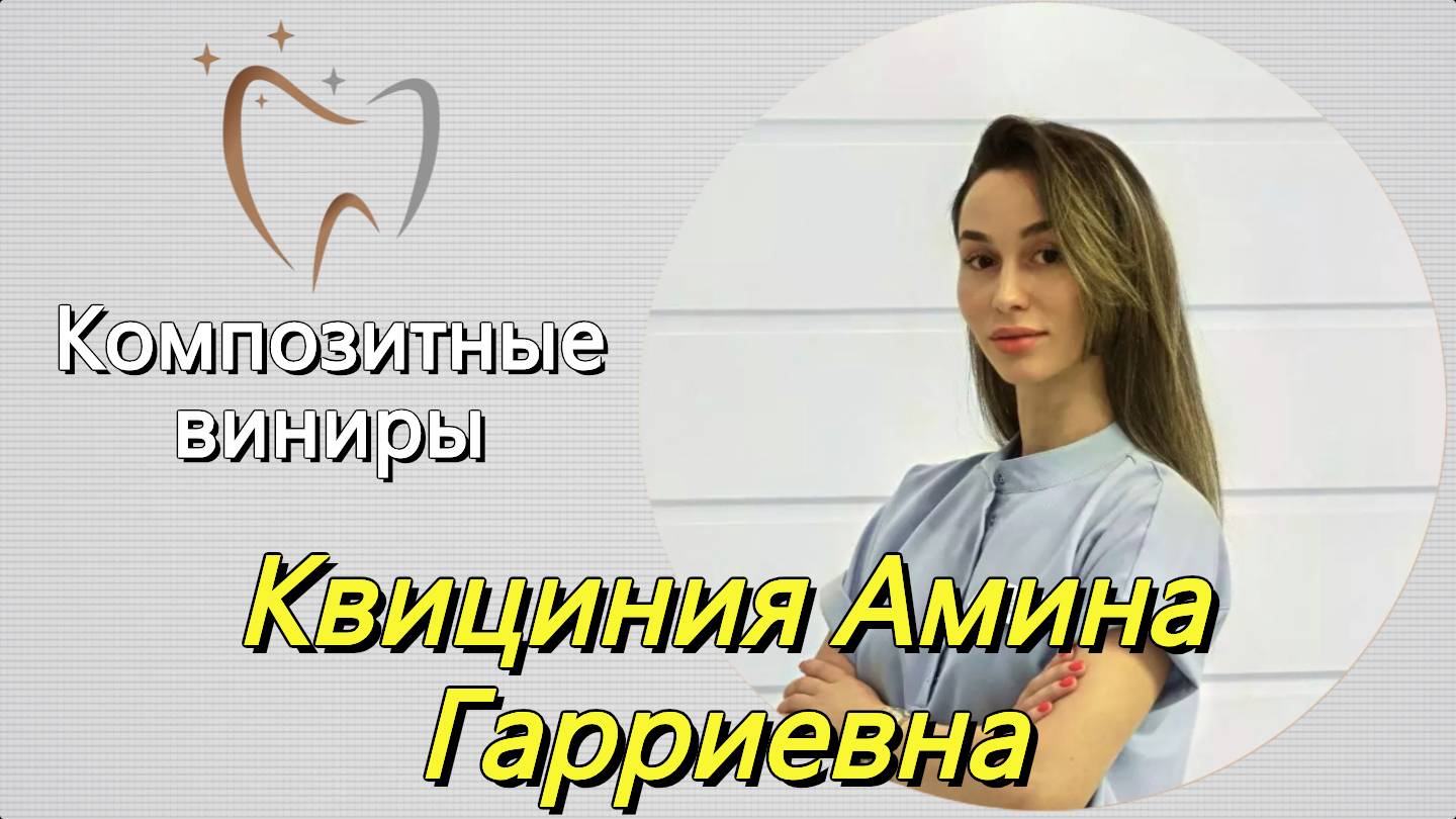💫 Композитные виниры