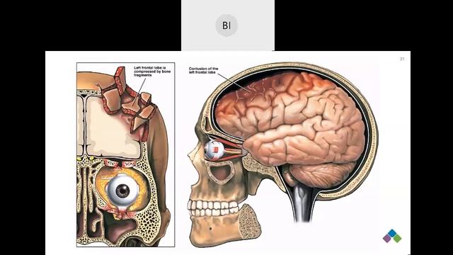 Domestic Violence and Brain Injury Training Part 1 Recording 2021 смотреть онлайн