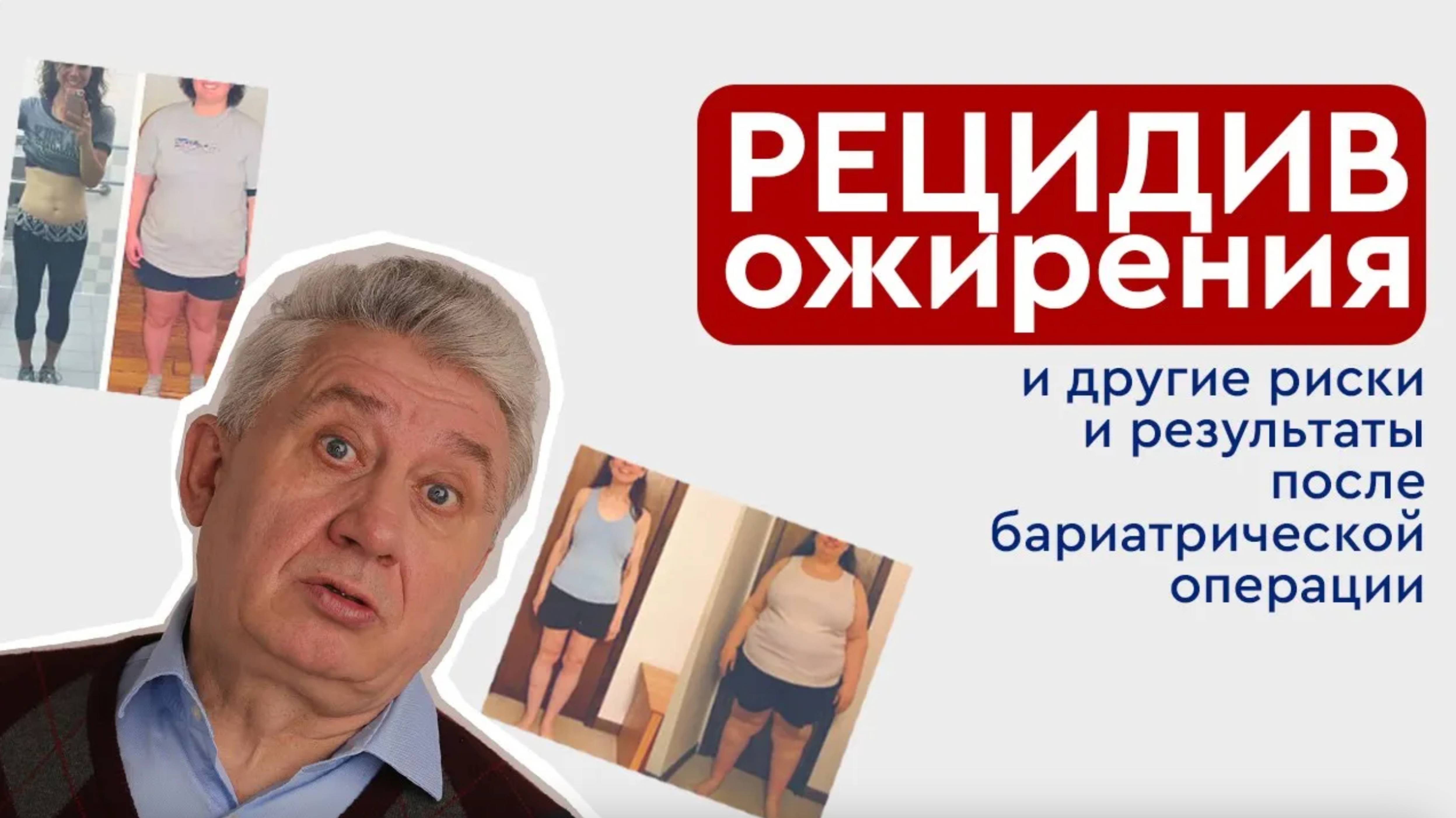 Показания к бариатрической операции. Как похудеть навсегда