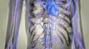 Как вылечить артрит