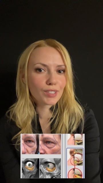 Самые частые эстетические проблемы под глазами смотреть онлайн