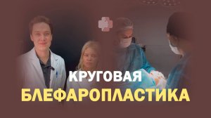 Открытый взгляд без лишней кожи и грыж — результат круговой блефаропластики