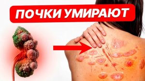 Сделай ЭТО с почками, пока не ПОЗДНО! Эти 5 признаков КРИЧАТ о проблемах с почками!