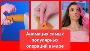 Залипательно, но страшно! Анимация самых популярных операций в мире