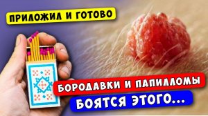 Бородавки и Папилломы Отсохнут с
Корнем! Возьми да намажь Обыкновенными...
