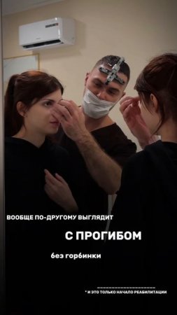 Ринопластика до после: первая реакция пациентки на результат операции