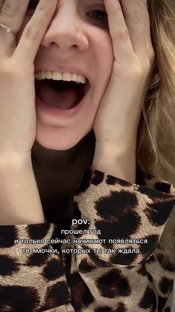 и пофиг, что из-за качества все сгладилось и даже не видно тех самых ямочек о которых идет речь