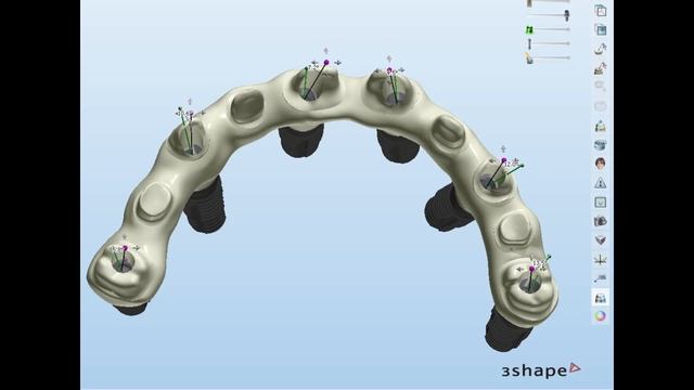 Implant Bar and Bridges 3Shape Dental System by Cdt Rami Aburadwan смотреть онлайн