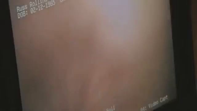 Dr. Butch Rosser Does Mini-endoscope (Scout Scope) Live on Monsters in the Morning смотреть онлайн